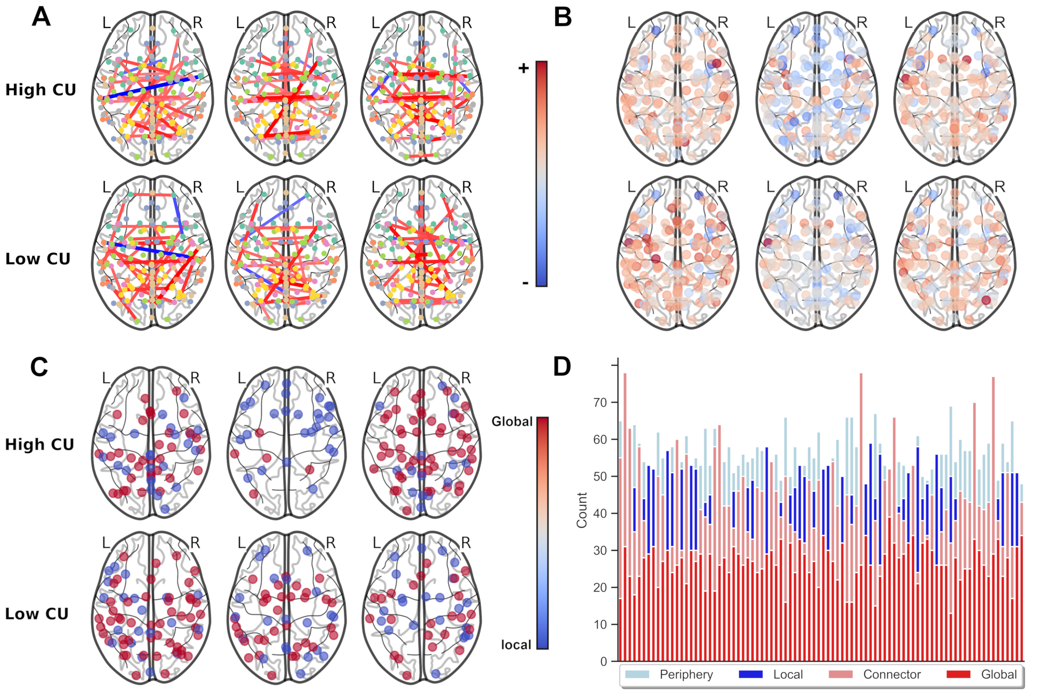 Lesionig Efficiency of heterogenous functional connectomes explains variance in ...